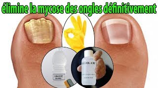 élimine la mycose des ongles définitivement  conseils [upl. by Eldrid]