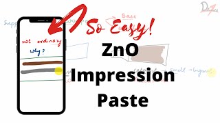 DENTAL MATERIALS  Zinc Oxide Eugenol Impression Paste [upl. by Mayhew]