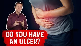 Understanding Ulcers How Do You Know If You Have One – Dr Berg [upl. by Pope251]