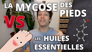 MYCOSE DES PIEDS  Remède naturel aux huiles essentielles [upl. by Essila]